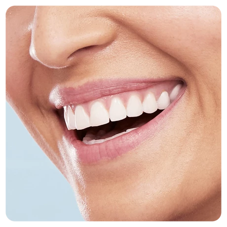 Braun Oral-B Pro 750 Cross Action fekete elektromos fogkefe utazótokkal